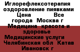 Иглорефлексотерапия, оздоровление пиявками › Цена ­ 3 000 - Все города, Москва г. Медицина, красота и здоровье » Медицинские услуги   . Челябинская обл.,Катав-Ивановск г.